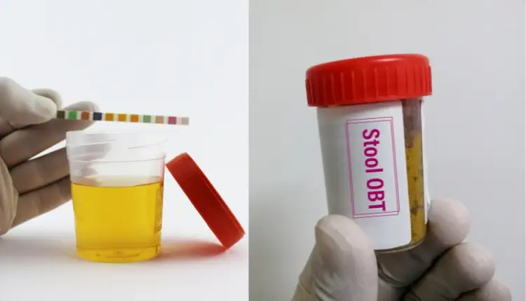 تحليل البول والبراز، ضمن أهم التحاليل الطبية للمرأة.